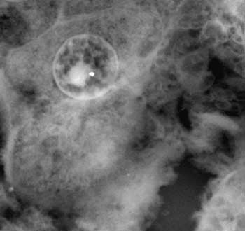 nanopatologia2.