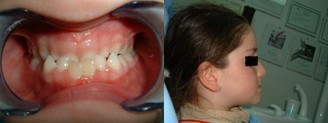 denti.