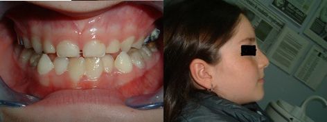 denti.