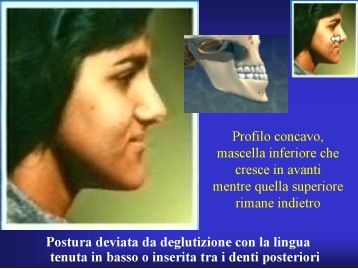 denti.