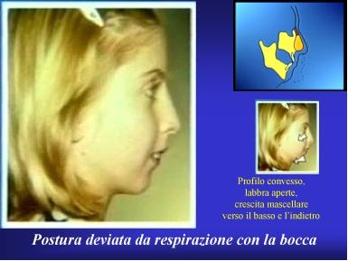 denti.